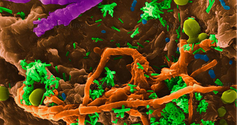 <i>‘Las bayetas pueden acumular seis veces más bacterias que el botón del váter’</i>